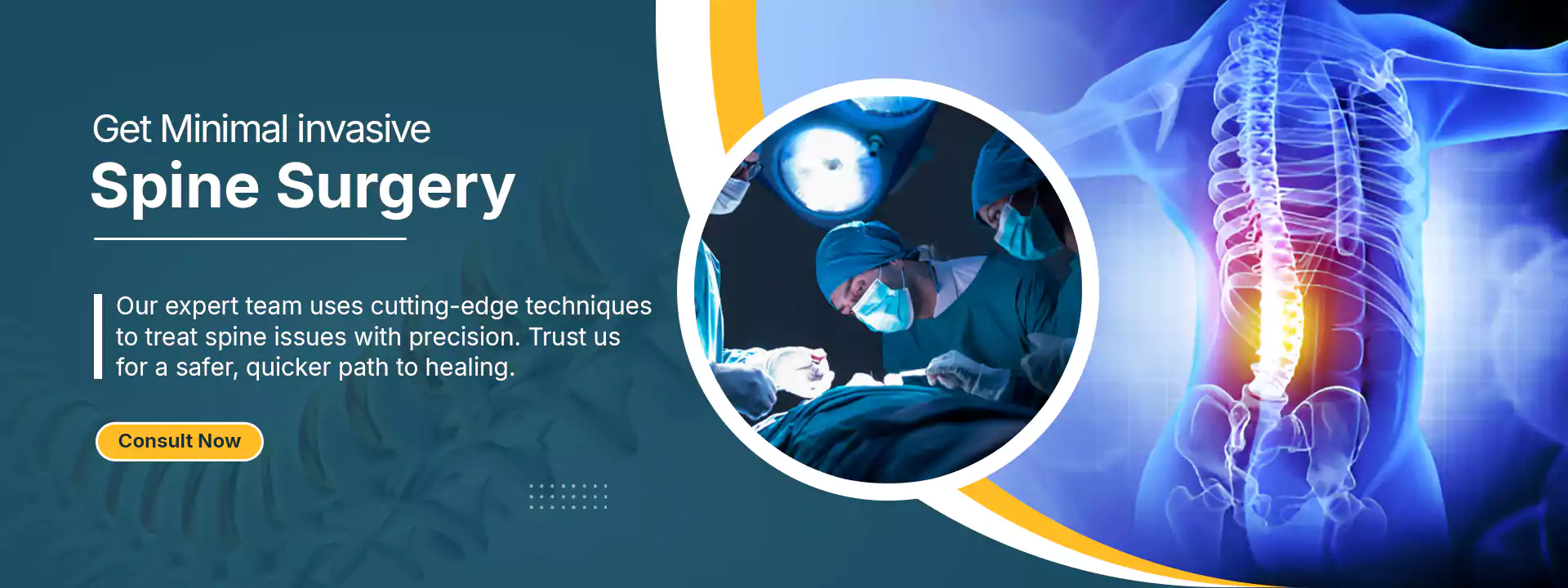 dr Naresh banner 2 - spine surgery